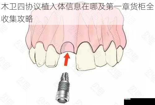 植入体信息所在位置